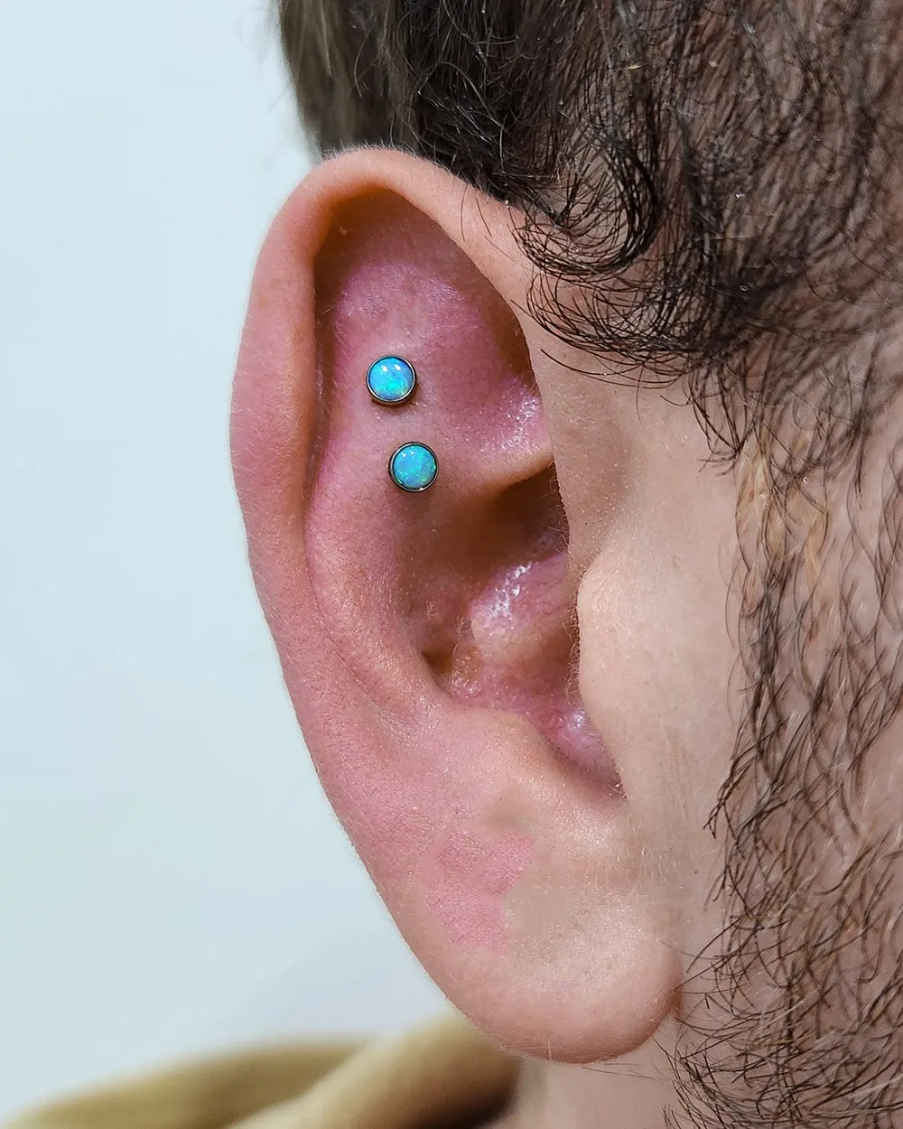 Opaline Azure Titanium Dermal Top